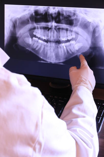 Best Knocked-Out Tooth (Avulsed Tooth) Treatment in Jim Thorpe, PA
